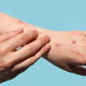 Image for article titled CDC Says We Probably Can't Get Rid of Monkeypox Now